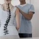How Is Scoliosis Treated? What is 3D Scoliosis Treatment?